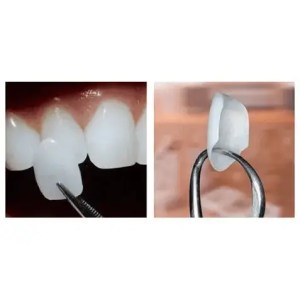 best dentist in miami,porcelain veneers miami,Botox miami,root canal cost miami,sinus lift miami,best veneers miami,best dentist south florida,best cosmetic dentist miami,best dental care miami,sage dental